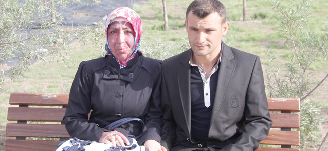 Yüzünü kaplayan doğum lekesi için yardım bekliyor