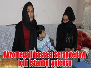 Akromegali hastası Serap tedavi için İstanbul yolcusu