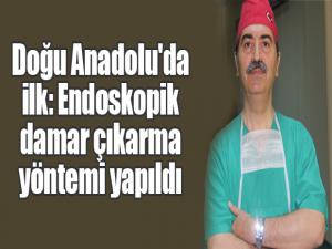 Doğu Anadolu'da ilk: Endoskopik damar çıkarma yöntemi yapıldı