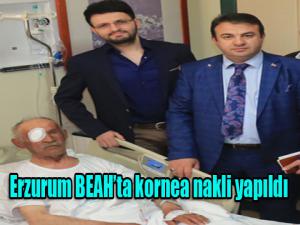 Erzurum BEAH'ta kornea nakli yapıldı