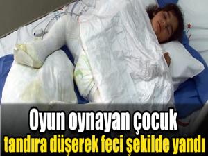 Oyun oynayan çocuk tandıra düşerek feci şekilde yandı