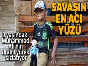 Savaşın en acı yüzü Suriyeli Muhammed