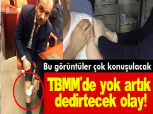 TBMM'de CHP Milletvekili, AK Partili Balta'yı bacağından ısırdı