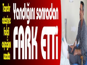 Tandır ateşine felçli ayağını uzatan adam yandığını sonradan fark etti