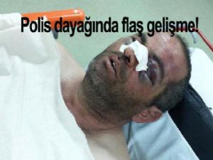 Polis dayağında flaş gelişme!