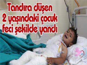 Tandıra düşen 2 yaşındaki çocuk feci şekilde yandı 