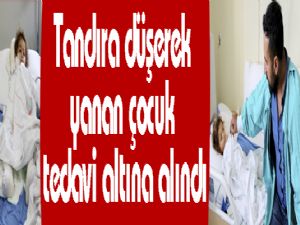 Tandıra düşerek yanan çocuk tedavi altına alındı